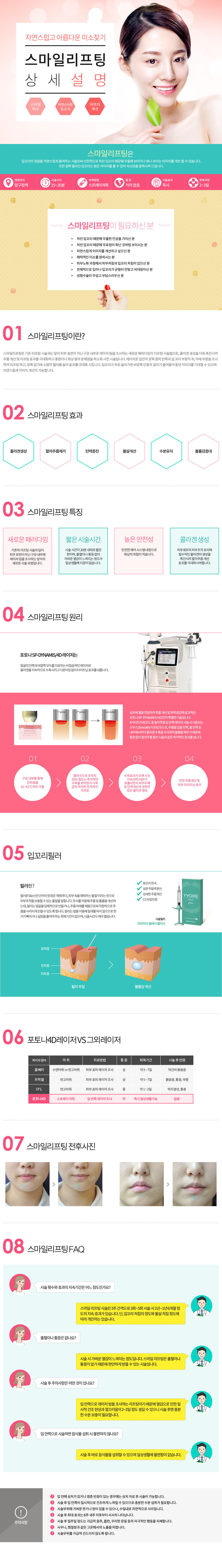 스마일리프팅 상세설명